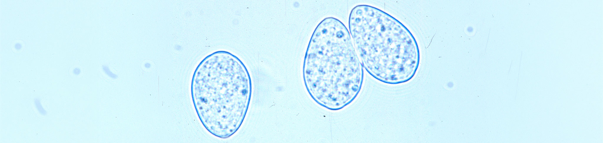 Oospores